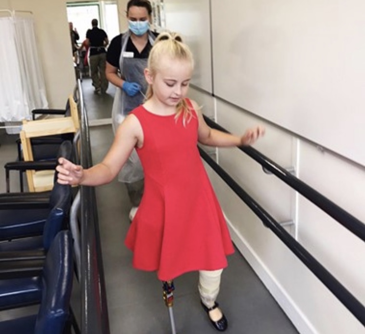 Daisy-May, la bimba che sfila con le protesi alle gambe